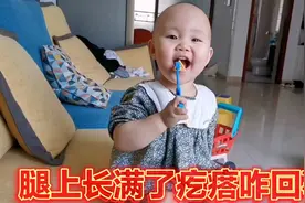 2岁宝宝腿上长满疙瘩，自己一个劲儿的喊疼，发生了什么视频封面