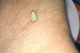 若要身体安，三里常不干。不灸足三里，勿为旅人。脾胃为后天之本视频封面