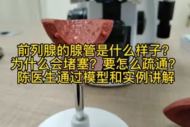 前列腺的腺管是什么样？为什么会堵塞？要怎么疏通？通过实例讲解视频封面