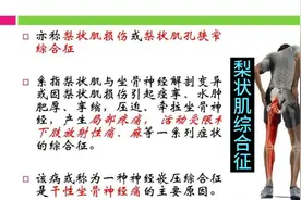 分享：梨状肌综合征（臀部疼痛）的调理过程！视频封面