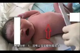 产妇没有奶水什么原因导致的视频封面