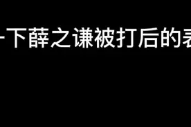 薛之谦被打后还打出音乐节拍来薛之谦会来看我作业成品吗@薛之谦视频封面