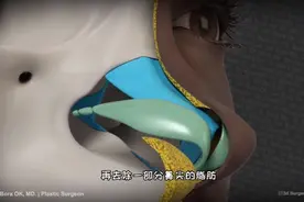 看了这个你还敢做吗，鼻整形手术过程，3D演示。。视频封面
