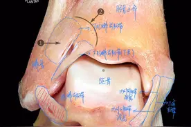 踝关节韧带高清解剖图，你知道扭伤脚踝伤的是哪根韧带吗？视频封面