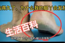 生活百科—站得久了，为什么我的脚丫会发胀？视频封面