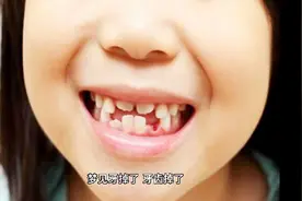 梦见牙齿掉了，代表着这些寓意，带着你的好朋友过来看看吧。视频封面