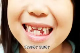 梦见牙齿掉了，代表着这些寓意，带着你的好朋友过来看看吧。视频封面