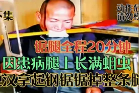 腿上长满蛆虫，拿起钢锯锯掉整条腿，背后原因令人心酸！视频封面