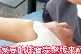 痛风石溶解排出完整版视频封面