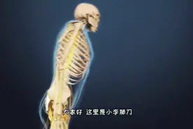 导致驼背的罪魁祸首，强制性脊柱炎的发生原因，3D演示。。