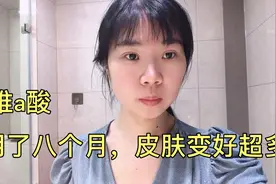 用维a酸的第八个月，皮肤明显变好了，变化真的很大！视频封面