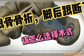 根骨微创跗骨窦切口做跟骨骨折手术视频封面