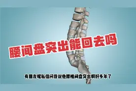 腰间盘突出，能按回去可以根治 ，真的吗？4分钟带你彻底了解