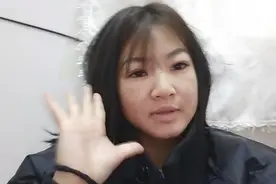 尿毒症女孩早上起来脸都是肿的，大早上起来换水透析管口又发炎了视频封面