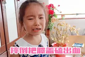 苒苒今天真倒霉：自己玩摔倒把膝盖磕出了血，哭鼻子开了视频封面