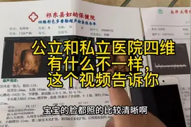 公立医院和私立医院四维有什么不同，这个视频告诉你最真实感受！
