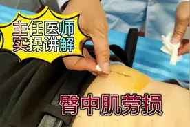 腰部疼痛原因分析，臀中肌劳损，针刀松解，快速缓解疼痛！视频封面