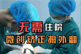 做拇外翻手术需要多久呢？微创矫正，时长一小时，不住院视频封面