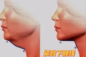 3个动作紧致下颚线，恢复20岁少女脸，坚持做50岁也不衰老视频封面
