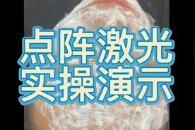 点阵激光，实操演示，专业人士操作视频封面