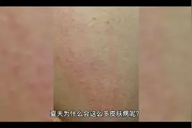臭水沟的故事