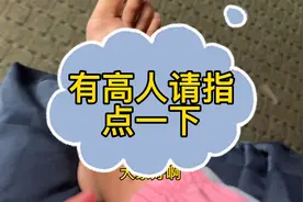 脚上一堆疙瘩超级痒 在线等高人指点 着急😣 #旅行的痛苦 #痒疙瘩视频封面