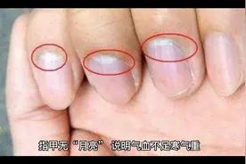 指甲无月亮，说明气血不足，寒气重