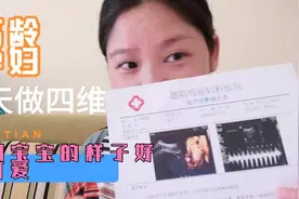 怀孕5个月的高龄孕妇，四维看到宝宝的样子心都融化了视频封面