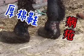 整腿僵硬肿大全是脓，大厚棉鞋捂脚气，后跟瘘疮露红肉希望快点好