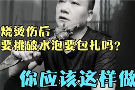 烧烫伤后要挑破水泡要包扎吗？你应该这样做！视频封面