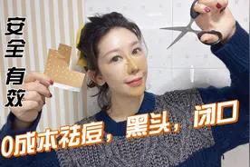 1个不花钱土方法，清除痘痘黑头闭口痘印，快帮孩子收藏视频封面