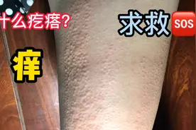 皮肤发痒，一抓就一大片小疙瘩，好吓人，怎么办？视频封面