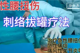 刺络拔罐疗法治疗急性腰扭伤（刺络放血拔罐，急性腰扭伤特效穴）视频封面