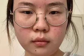 圆脸肿眼泡➕近视 咋化低饱和眼镜👓妆？视频封面