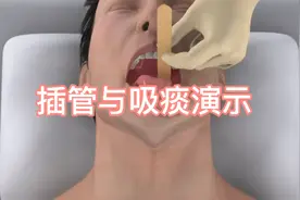 插管与吸痰过程演示！视频封面
