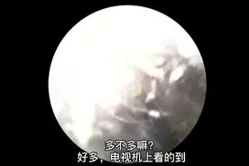 耳热，搽了Y，耳屎变少视频封面