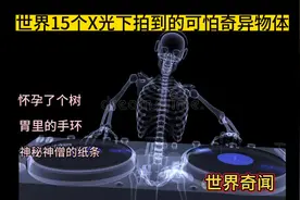 15个 X光拍到的可怕奇异物体，好奇那个和尚体内汉语纸条是什么视频封面