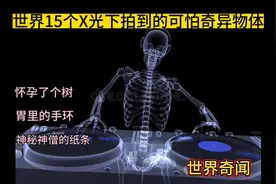 15个 X光拍到的可怕奇异物体，好奇那个和尚体内汉语纸条是什么视频封面