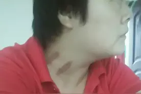 2O多岁美女得一种怪病，想思病，，想老公在屋个月没吃东西