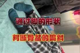 正骨和破案一样，通过肢体语言判断骨的偏斜视频封面