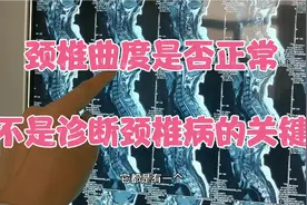从一65岁男性颈椎病患者磁共振片子看颈椎曲度视频封面