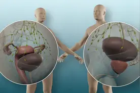 太暴力，器官都切没了，机器人膀胱癌切除术，3D演示。。