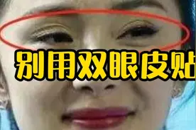 杨幂的眼睛为什么变成了多眼皮？视频封面