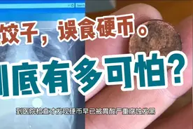 吃饺子，误食硬币。医生建议:饺子最好不要包硬币以免发生意外。视频封面