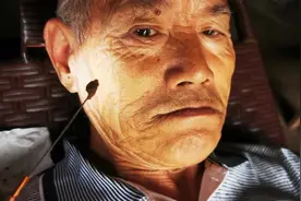 公益掏耳朵，爷爷两个耳朵都有耳结石，耳朵堵住听力明显下降了