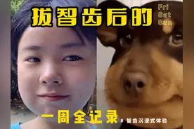 拔智齿后的一周，7天全记录，这辈子终于和智齿们say good bye 了