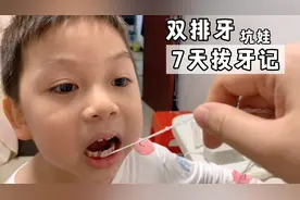 6岁娃悄悄长出双排牙，用7天时间把牙齿摇松，宝妈用毛线成功拔牙