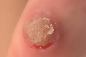 挑战你不笑  484视频封面