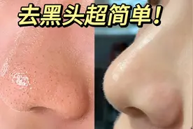 30秒教会你去黑头的方法，真的超简单！