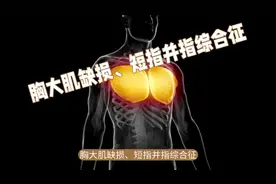 胸大肌缺损、短指并指综合征